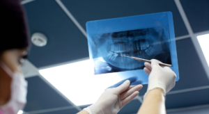 A Importância da Reconstrução Óssea e Gengival na Odontologia Moderna