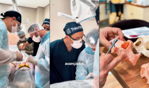 Implantodontia Avançada: Soluções para Maxilas Severamente Atróficas